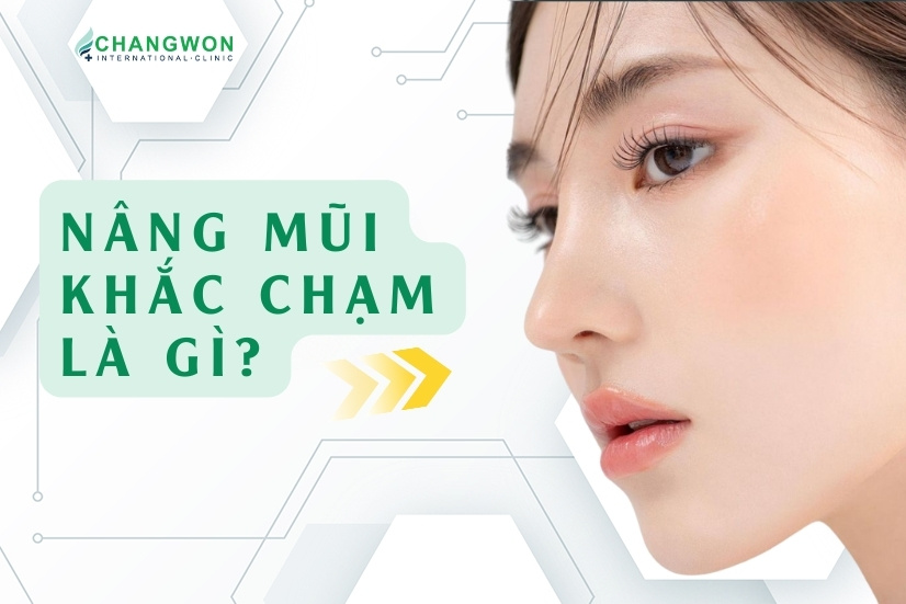 nâng mũi khắc chạm là gì