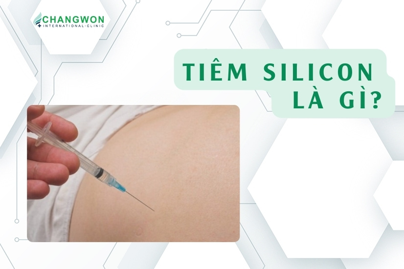 tiêm silicon là gì