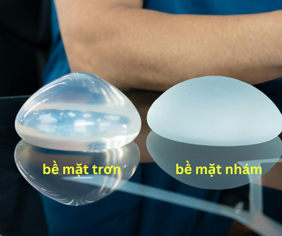 túi ngực theo bề mặt